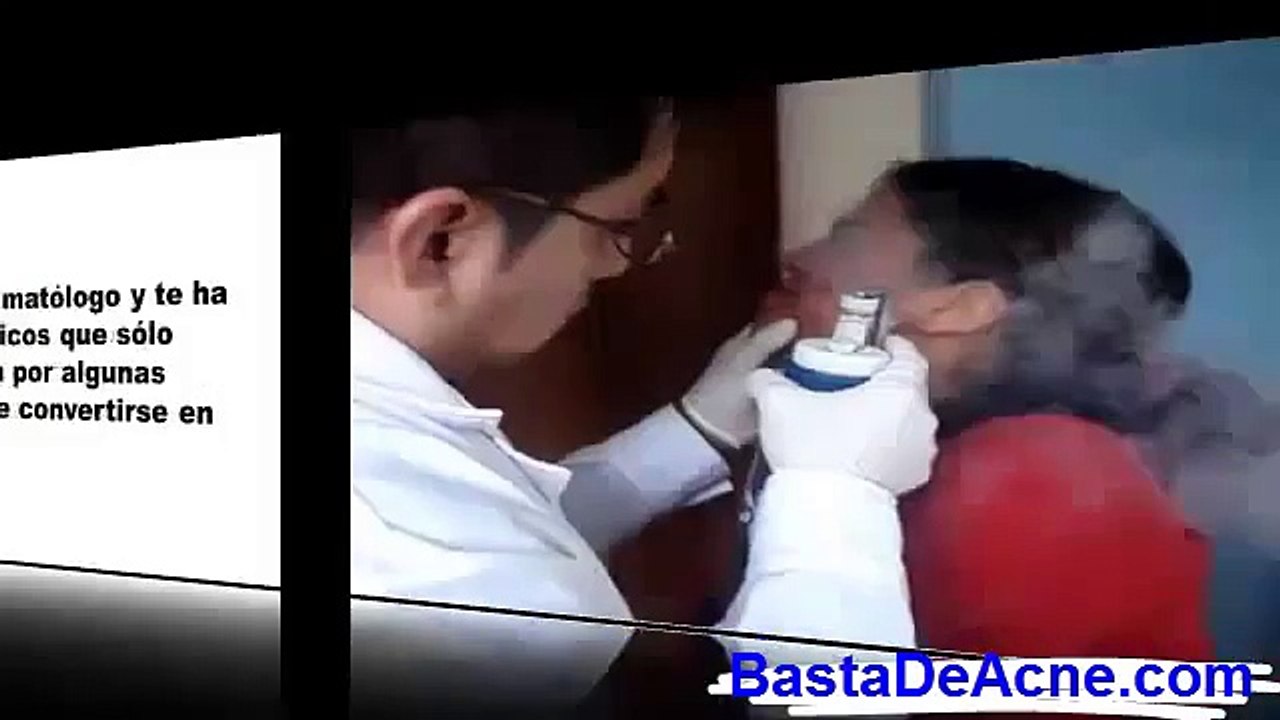 Acne Severo Tratamiento Natural | El Milagro Para el Acne [Como Eliminar Barros y Espinillas]