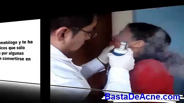 Acne Severo Tratamiento Natural | El Milagro Para el Acne [Como Eliminar Barros y Espinillas]