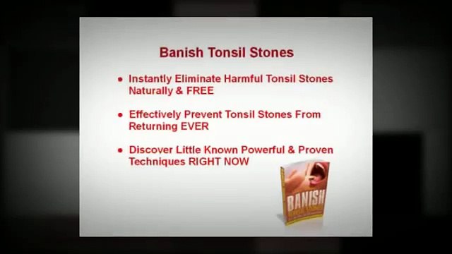 Banish Tonsil Stones | Banish Tonsil Stones Download