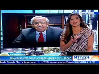 “Niña milagro” sabe que es especial y asegura que su corazón que está fuera del pecho es hermoso