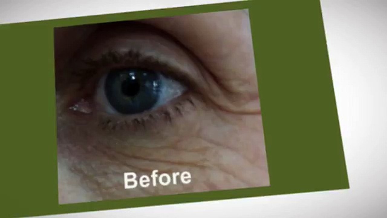 30MinuteFaceLift.net: Free Secret Formula For Facelift Without Surgery!!