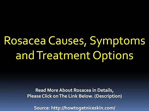 Rosacea Info: Causes, Symptoms and Treatment Options