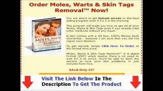 Moles Warts Removal Review | Is Moles Warts And Skin Tags Removal All It's Cracked Up To Be?