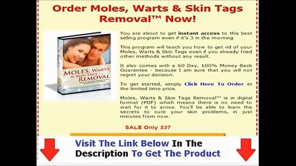 Moles Warts Removal Review | Is Moles Warts And Skin Tags Removal All It&#39;s Cracked Up To Be?