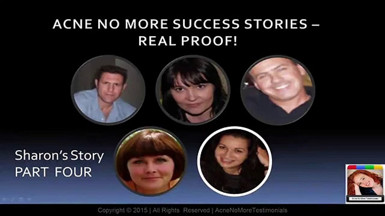 Acne No More Review - Sharon's Acne No More Success Story - Part 4