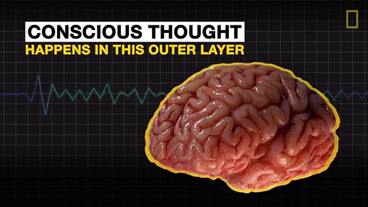Why Your Brain is Wrinkly