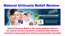 urticaria treatment Natural Urticaria Relief Review - Scam or Credible ?