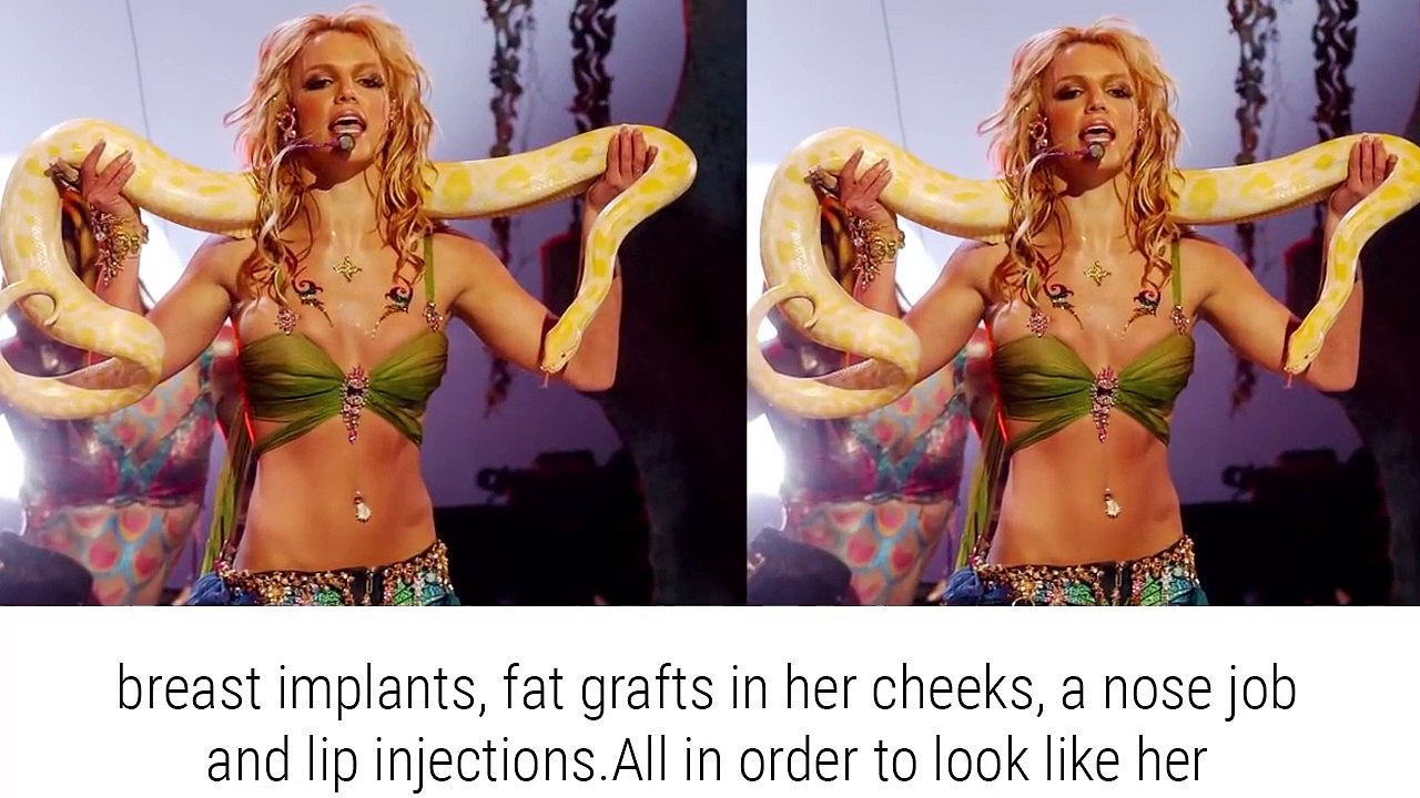 10 People Who Abused Plastic Surgery To Look Like Celebrities