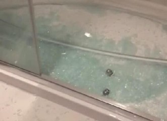 Yeliz Yeşilmen, evinde yaşadığı talihsiz kazada büyük korku yaşadı