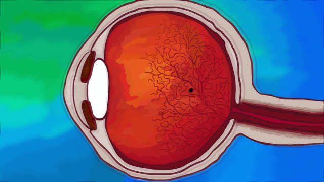 Плавающие объекты в наших глазах — что это такое?