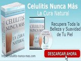 Celulitis Nunca Mas Testimonio - Celulitis Nunca Mas
