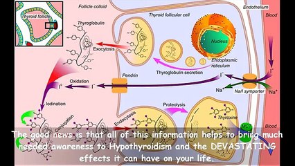 Does The Hypothyroidism Revolution Work | Warning | Does The Hypothyroidism Revolution Really Work