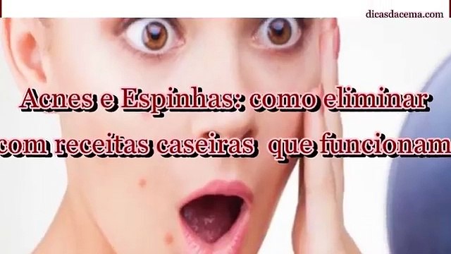 Receitas caseiras para eliminar acnes e espinhas -dicas da Cema