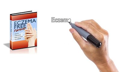 "Eczema Free Forever Review" ↪↪ Really Best Eczema Treatment or Scam?