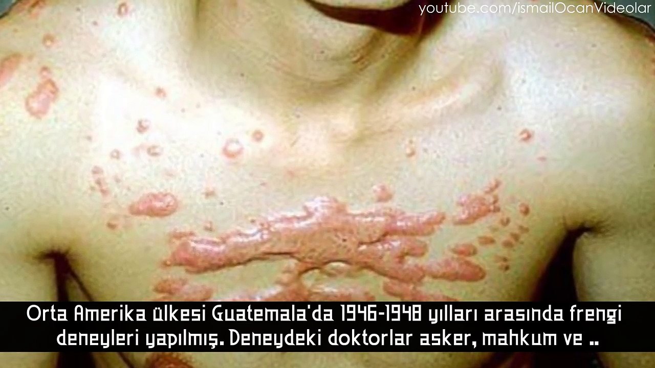 Tarihte Yapılmış insanlık Dışı 10 Korkunç Deney