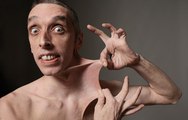 Stretchiest Skin - Dehnbarste Haut der Welt! - Guinness World Records