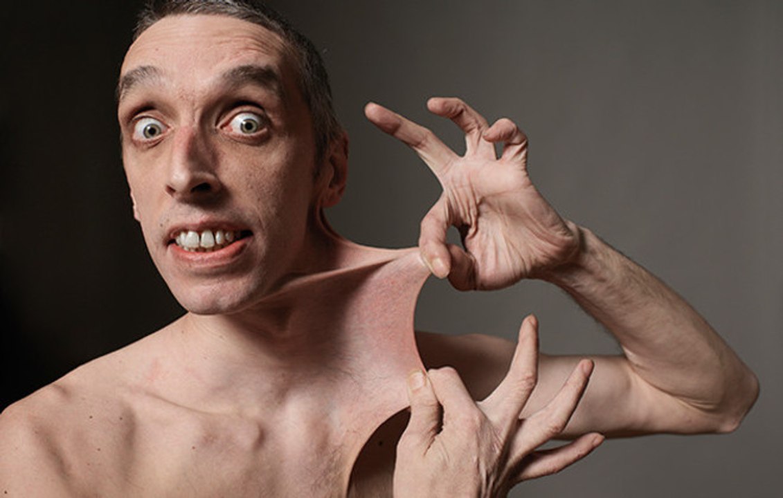 Stretchiest Skin - Dehnbarste Haut der Welt! - Guinness World Records