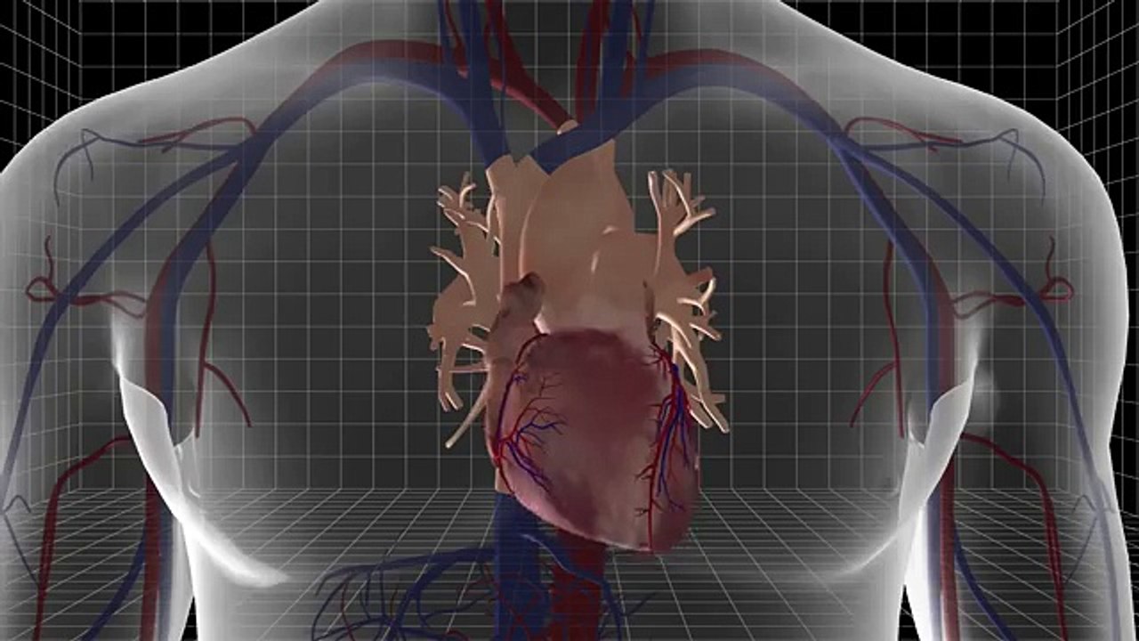 CARMAT heart