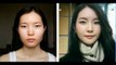 Korean Plastic surgery celebrities showbiz Before and after 03