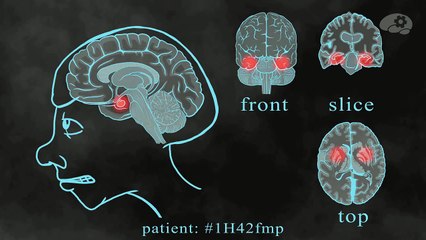 Зомби среди нас - мозг и поведение
