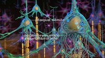 Une vidéo d'information sur la maladie d'Alzheimer