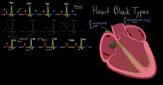 Major Types of Heart Block - Congestive Heart Failure (360p)