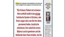 Nie mehr Akne (TM) Von Mike Walden