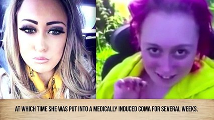 Shocking Before-And-After Drug Use Photos