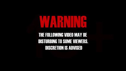 Dengesini Kaybedip Göğsüyle Arabaya Çarpan Şanssız Motorcu