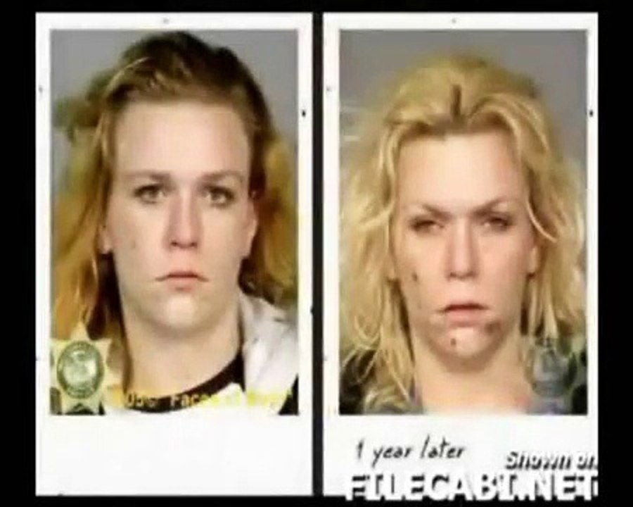 Before and after, The consequence of drugs
