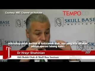 Langka-26-Tahun-Janin-Ini-Ada-di-Kepala-Yamini.flv