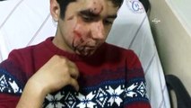 Polisin gaz kapsülü, 14 yaşındaki öğrencinin yüz kemiğini çatlattı