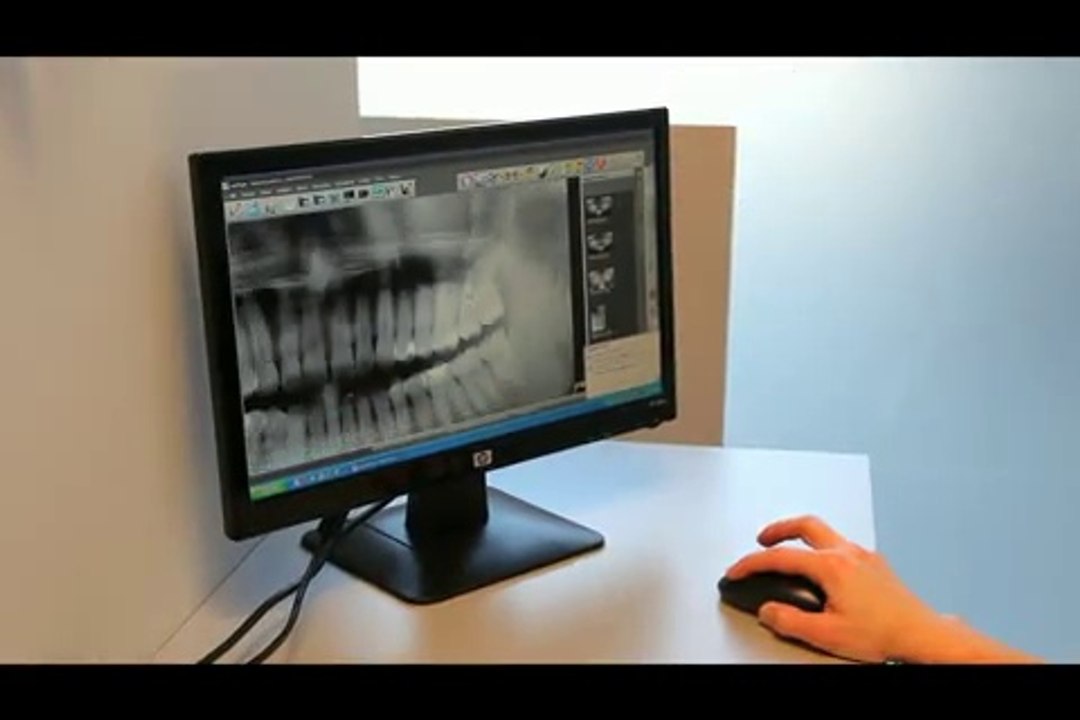 Tannlege Polen Movie