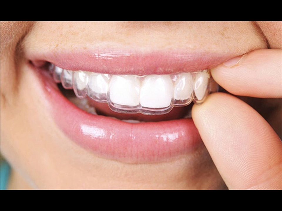 How the orthodontist works