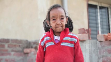 Real Life 'Benjamin Button' Children with Rare Aging Disease Undergo Tests in India