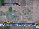 2-year-old kicked in face by horse