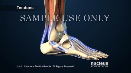 Ankle Fracture Repair