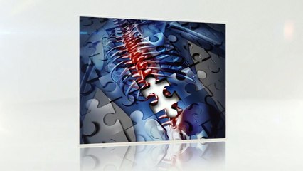 Thoracic Surgeon Plano TX: Learn About Recovering from Kyphoplasty