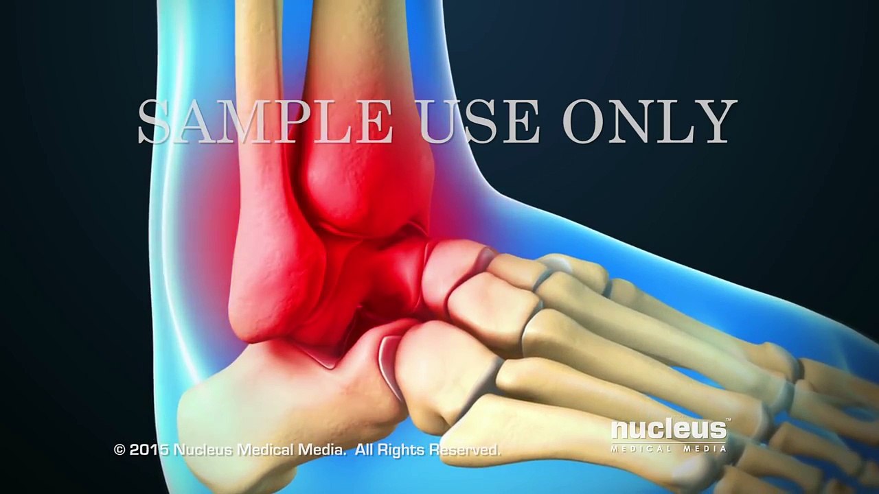 Ankle Scope