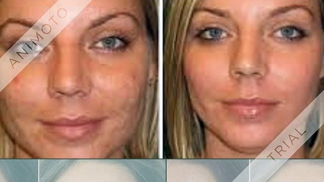 Glowing dermis is usually a nice raise to your confidence