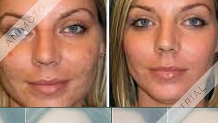 Glowing dermis is usually a nice raise to your confidence