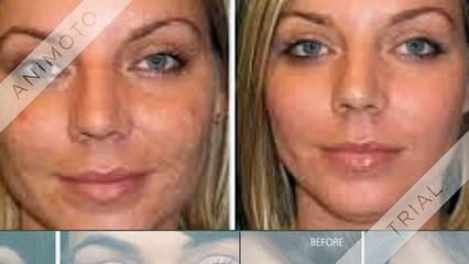 There are five different types of skin