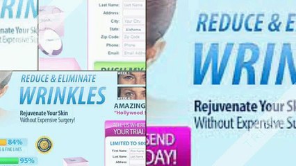 Wrinkles and beneath-eye baggage is a narrative of just about