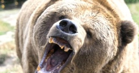 Ayının Parçaladığı Yüzü Prof. Dr. Özkan Tedavi Edecek