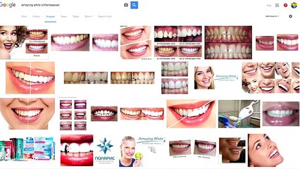 Чем лечить дисбактериоз