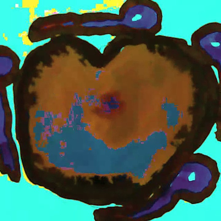 Thomas Riesner -Kunst und Psychiatrie 2