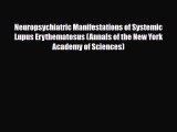 [PDF] Neuropsychiatric Manifestations of Systemic Lupus Erythematosus (Annals of the New York