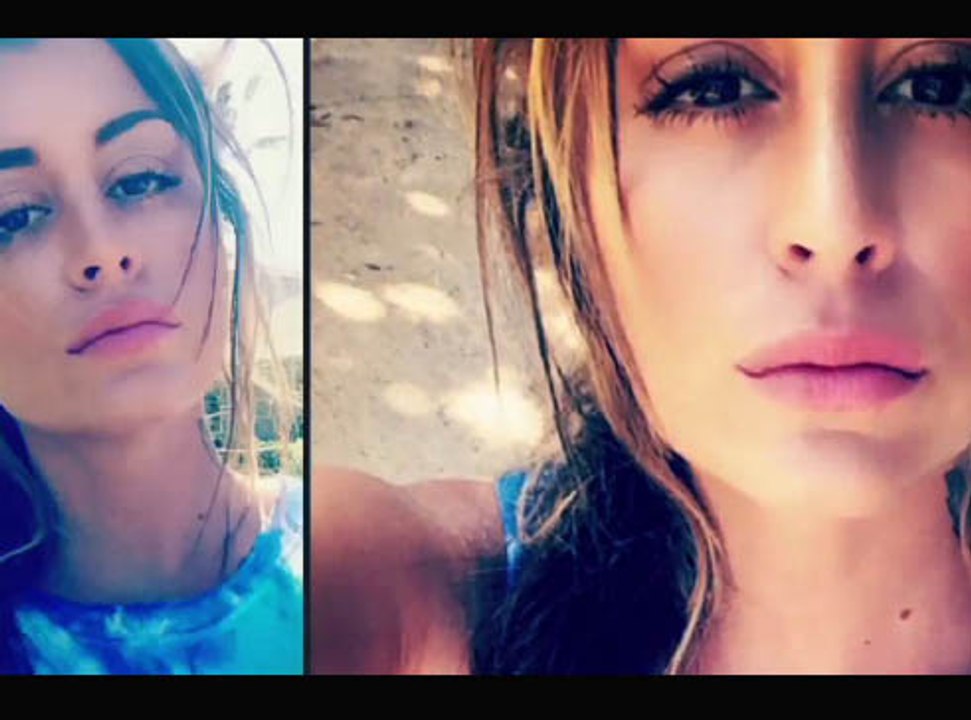 Exclu Vidéo : Anaïs Camizuli : Découvrez son nouveau visage  !