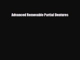 [PDF] Advanced Removable Partial Dentures [Download] Online