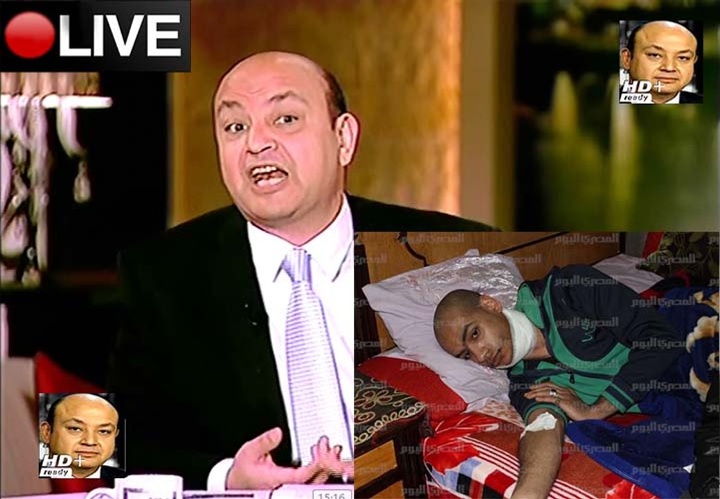 عمرو أديب القاهرة اليوم حلقة الثلاثاء 16-2-2015 الجزء الثانى - كسر فك مواطن على يد ضابط شرطة